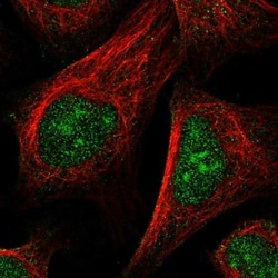 Nucleoplasmin-2 Antibody, Novus Biologicals 0.1mL; Unlabeled:Antibodies,